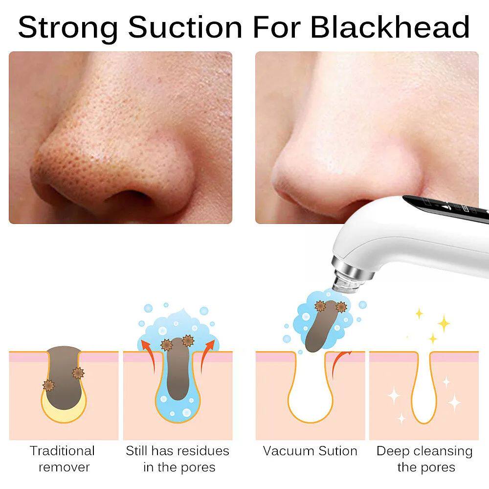 Electric Facial Pore Cleanser