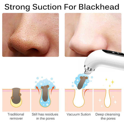 Electric Facial Pore Cleanser