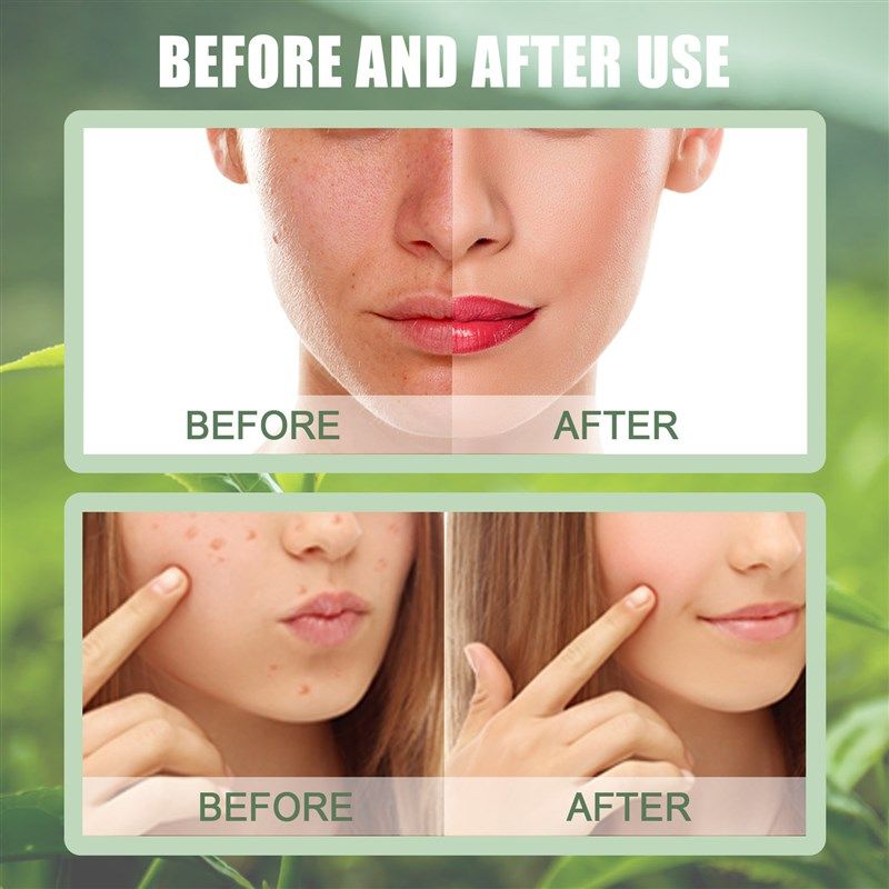 Green Tea Facial Mask