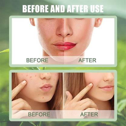 Green Tea Facial Mask
