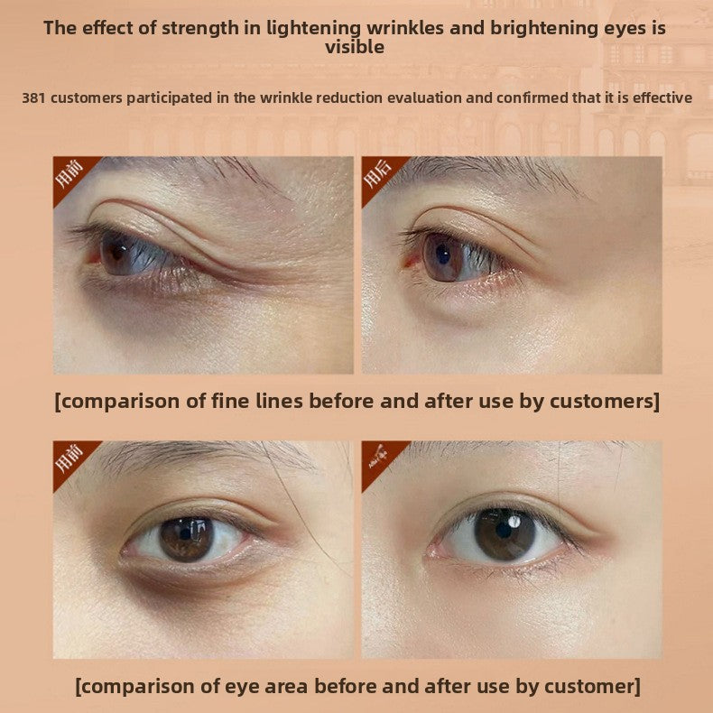 Hyaluronic acid eye cream