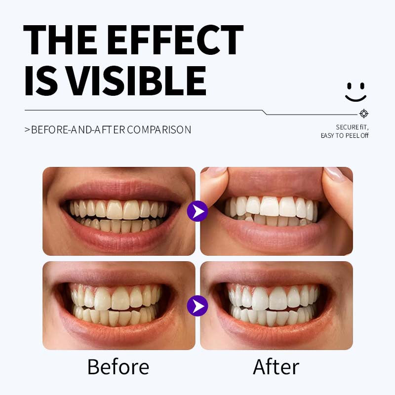 Brightening, cleaning and caring tooth strips