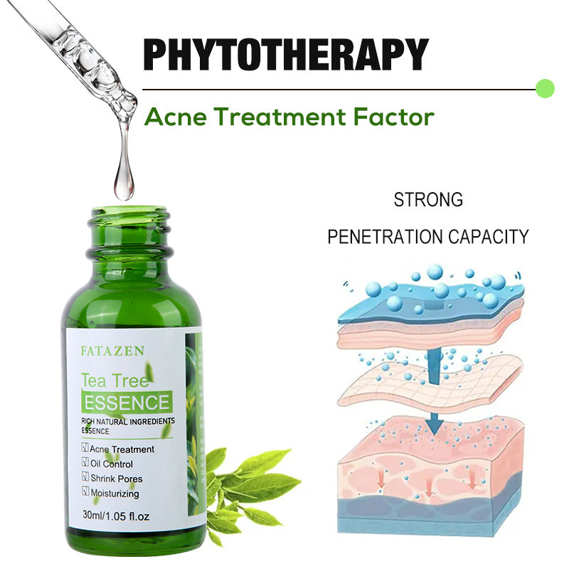 Green Tea Anti-Acne Essence Liquid