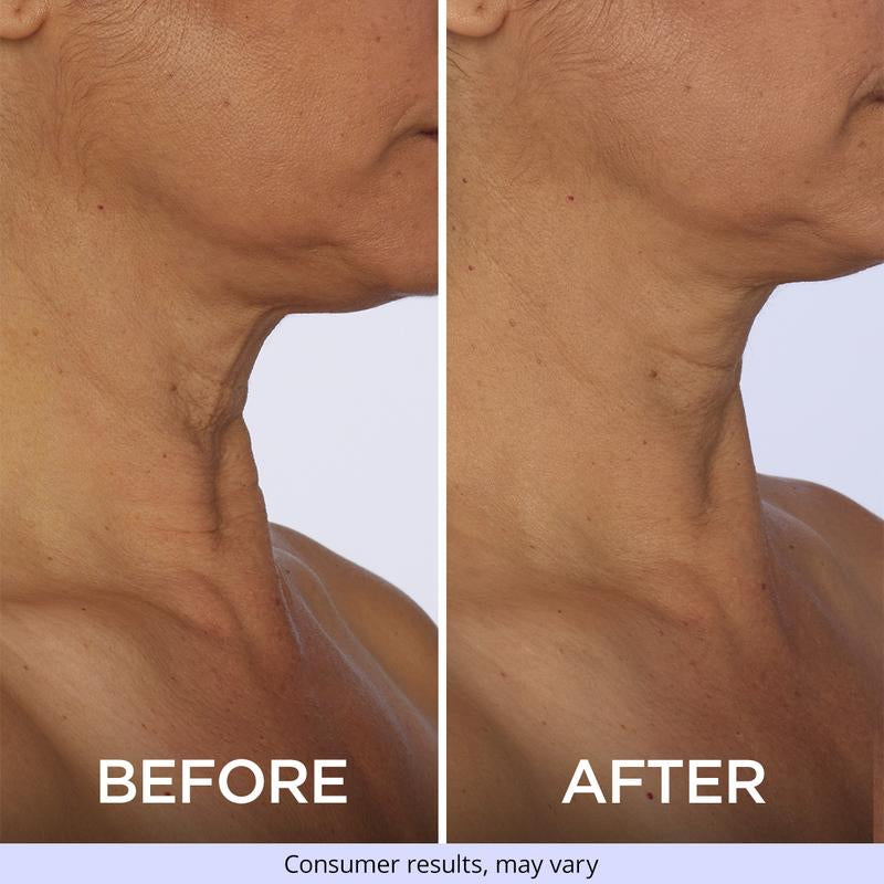 GOPURE Neck Cream Tighten & Lift Firming Cream for Crepey Skin