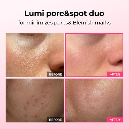 Pink Spicule Serum with Calcium Hydrating Set