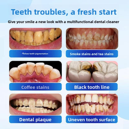 Electric Teeth Cleaning Polisher with Whitening Function