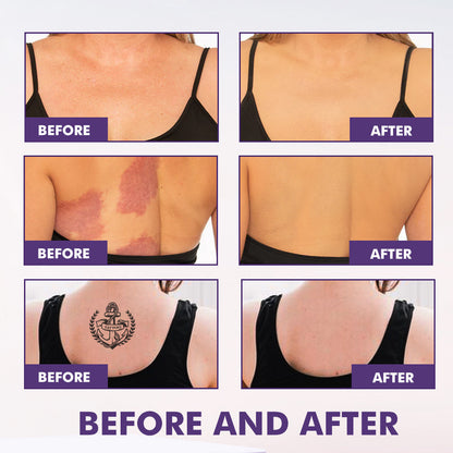 Waterproof Moisturizing Body Concealer Cream