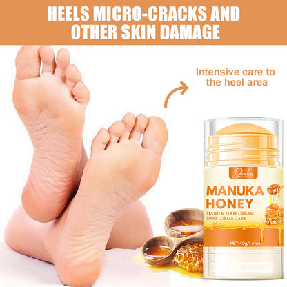Honey Moisturizing Foot Cream for Dry Cracked Skin