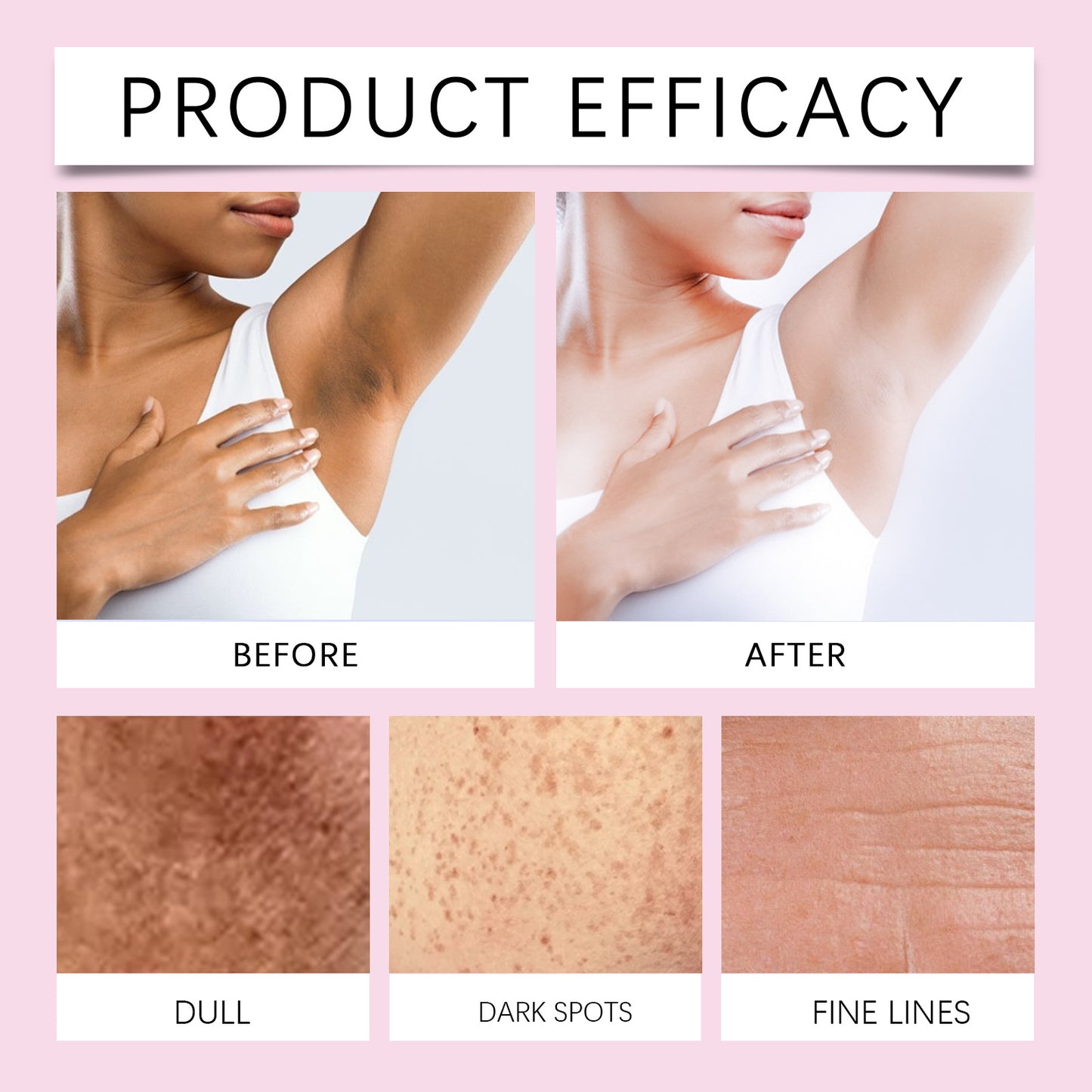 Body Dark Spot Correcting Moisturizing Cream