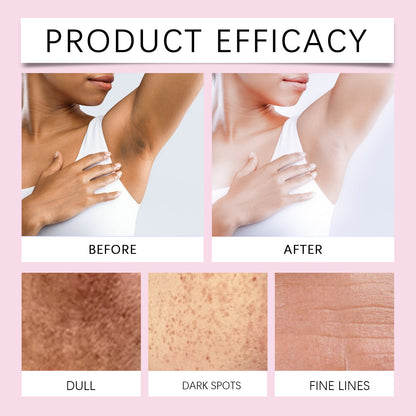 Body Dark Spot Correcting Moisturizing Cream