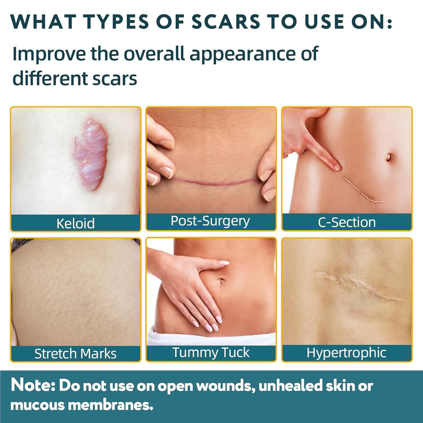 Medical Grade Silicone Scar Treatment Sheets