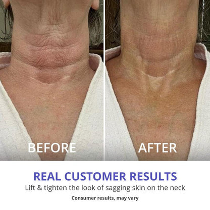 GOPURE Neck Cream Tighten & Lift Firming Cream for Crepey Skin
