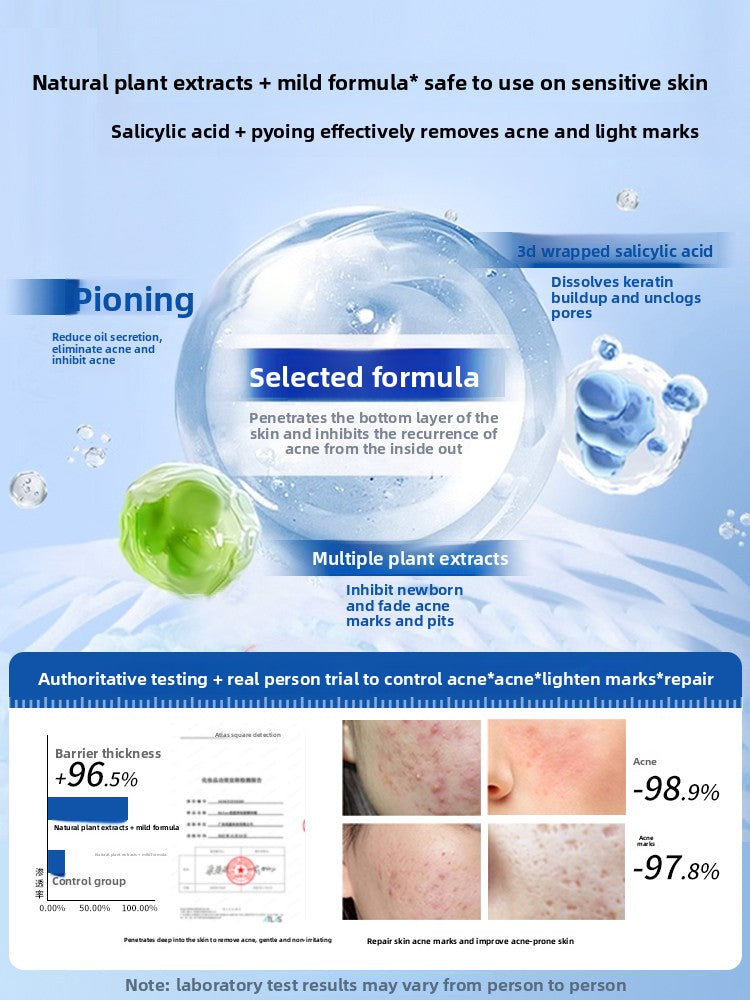 Acne Treatment Serum with Salicylic Acid