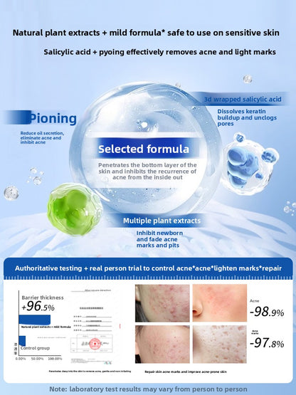 Acne Treatment Serum with Salicylic Acid