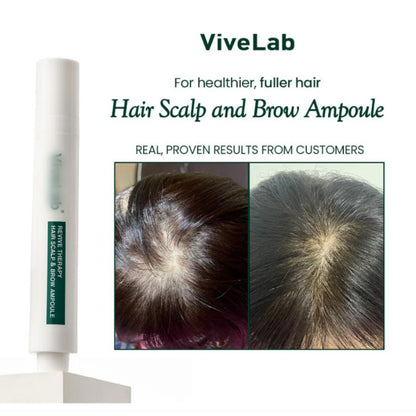 Hair Growth Serum for Thinning Hair